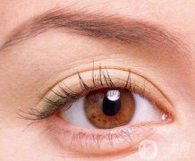 雙眼皮會(huì)變回嗎?怎么割雙眼皮有肉條?