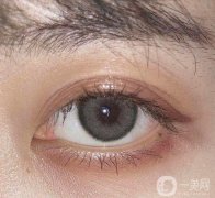 韓式三點(diǎn)雙眼皮價格多少?韓式三點(diǎn)式雙眼皮多少錢的影響因素