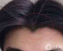 種植美人尖后的好處有哪些？種植美人尖后有什么危害嗎？