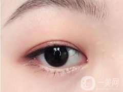 眼皮吸脂多少錢?抽脂后眼皮還會再長脂肪胖嗎?