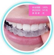 牙齒內扣怎么矯正?牙齒內扣有哪些矯正方法?