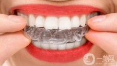 矯正牙齒需要多長時間?矯正調節(jié)時間長嗎?