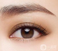 什么樣的眼睛適合割雙眼皮?做雙眼皮手術要多久?恢復期有多長?