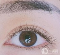 為什么會有腫泡眼?腫泡眼怎么改良?