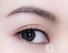 做雙眼皮哪種自然？你適合哪一種雙眼皮？