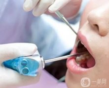 清潔牙齒對牙齒的好處是什么？洗牙后如何刷牙？