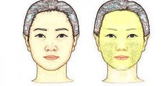 自體脂肪可以填充哪些部位