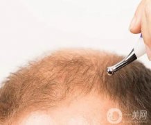 植發(fā)有沒(méi)有風(fēng)險(xiǎn)呢？植發(fā)后需要注意什么？
