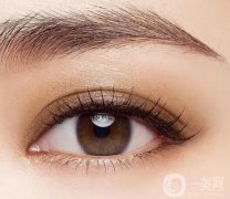 什么是全切雙眼皮？全切雙眼皮是如何恢復(fù)的？