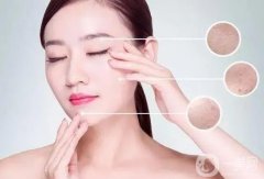光子嫩膚在哪里可以做？美容院可以做光子嫩膚嗎？