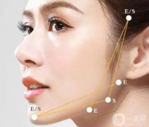 切骨瘦臉手術(shù)會(huì)出現(xiàn)哪些并發(fā)癥？切骨一次需要多長(zhǎng)時(shí)間？