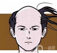 男性脫發(fā)怎么辦?脫發(fā)真的沒救了嗎?