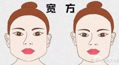 隨著年齡臉越來越大、方,該怎么辦?
