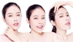 頰脂墊切除方法原來(lái)是在口腔內(nèi)展開(kāi)的?