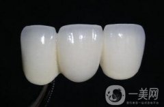 做一個烤瓷牙套要多少錢?做烤瓷牙要多少錢?