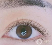 雙眼皮失敗的體現(xiàn)在哪？這七點需要注意！