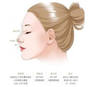 鷹鉤鼻矯正貴嗎?術(shù)前準(zhǔn)備及術(shù)后護理總結(jié)