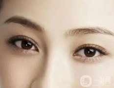 通常哪些人不適合開眼角？疤痕體質(zhì)不適合開眼角？