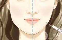 整容有什么副作用:黑臉娃娃、*的副作用