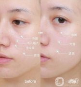 打*有沒有副作用呢，副作用是什么?