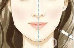 注射除皺和玻尿酸相比信息介紹呢，有什么區(qū)別