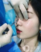 玻尿酸隆鼻可以管多久，玻尿酸隆鼻的風險有哪些？