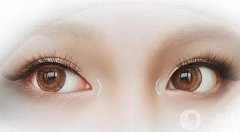 雙眼皮手術后如何避免留下疤痕？如何修復雙眼皮失??？