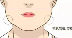 如何讓咬肌變小?非手術方法可以改良咬肌嗎?