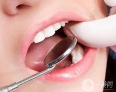 洗牙會(huì)有痛感嗎？刷牙可以代替洗牙嗎?
