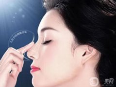 隆鼻手術時間是多長？