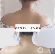 間隔多長時(shí)間打一次注射瘦肩?
