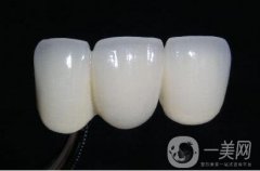 烤瓷牙可以做核磁共振嗎?電動(dòng)牙刷可以刷烤瓷牙嗎?