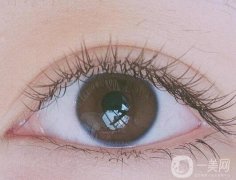 割雙眼皮需要忌口嗎?割雙眼皮的常見(jiàn)誤區(qū)