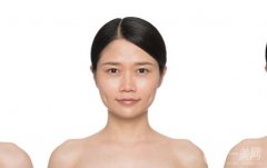 注射注射瘦肩后應(yīng)該注意什么？有風(fēng)險(xiǎn)嗎？