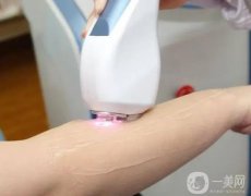 為什么超冰脫毛的痛感更低？是不是*的？