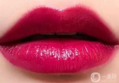 漂唇的價(jià)格是多少？