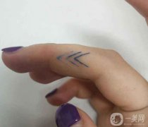 紋身暈開的原因是什么？紋身后的注意事項(xiàng)？
