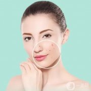 點(diǎn)痣會不會很痛？微晶磨削點(diǎn)痣后如何護(hù)理？