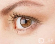 眼皮抽脂多少錢?眼瞼吸脂術(shù)后注意事項?