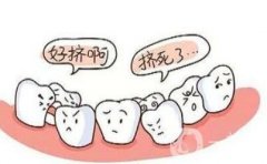 兒童地包天矯正果怎么樣？