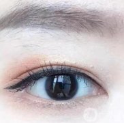 雙眼皮割寬了可以修嗎?雙眼皮修復后注意事項?