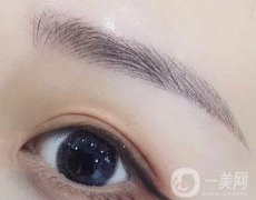 什么是4d提眉術(shù)?提眉術(shù)有什么果?