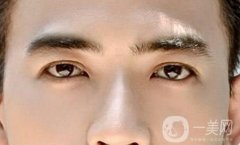 男人做提眉術(shù)好嗎?用三角眼做提眉術(shù)果好嗎?