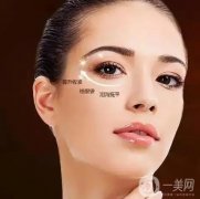 去除眼袋手術是否需要住院?眼袋手術的恢復期有多長?