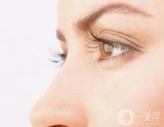 雙眼皮手術(shù)失敗會(huì)發(fā)生什么?會(huì)導(dǎo)致什么后果?