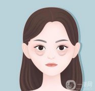 眼袋去除手術(shù)多少錢(qián)?去除眼袋有哪些誤區(qū)