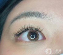 種植睫毛的價(jià)格是多少?種植睫毛可以維持多少時(shí)間？