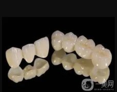 做烤瓷牙的心得體會(huì)