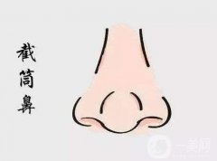 鼻頭縮小需要多少錢?鼻頭縮小有什么優(yōu)缺點(diǎn)