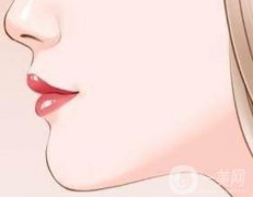 玻尿酸墊下巴會(huì)有后遺癥嗎？注射下巴后如何護(hù)理
